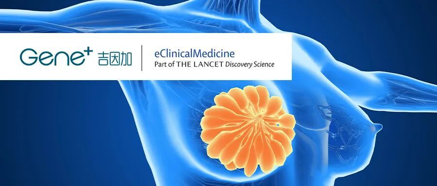 多中心真实世界研究：基于血浆ctDNA改变的转移性乳腺癌亚型临床分析